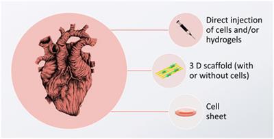 How to fix a broken heart—designing biofunctional cues for effective, environmentally-friendly cardiac tissue engineering